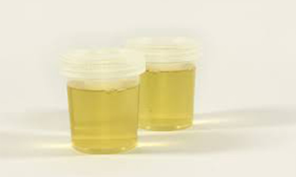 urine test tips