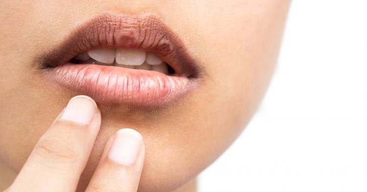शुष्क मुँह का घरेलु इलाज एवं शुष्क मुँह से बचाव के तरीके